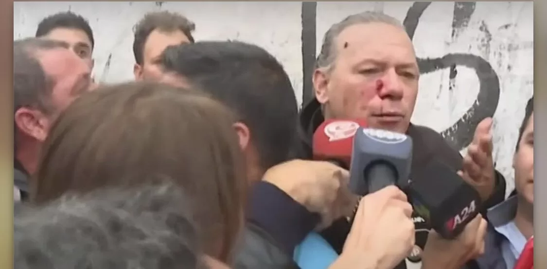 Brutal ataque a Sergio Berni