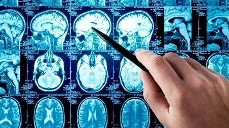 Científicos argentinos crean asistente virtual para reconocer síntomas de ACV